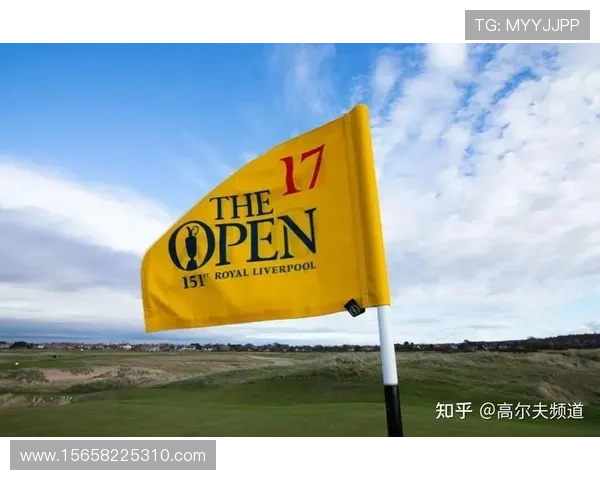 帕尔特伊获准出战英格兰赛前瞻